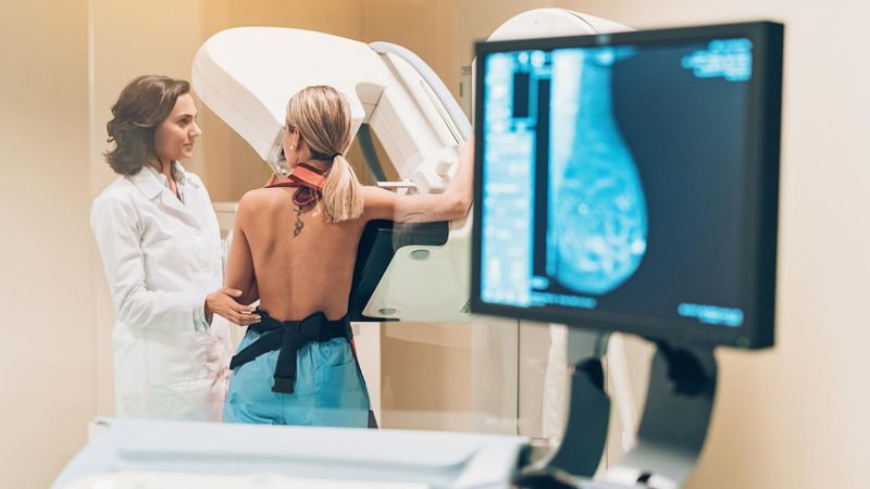 Illustration d'une mammographie
